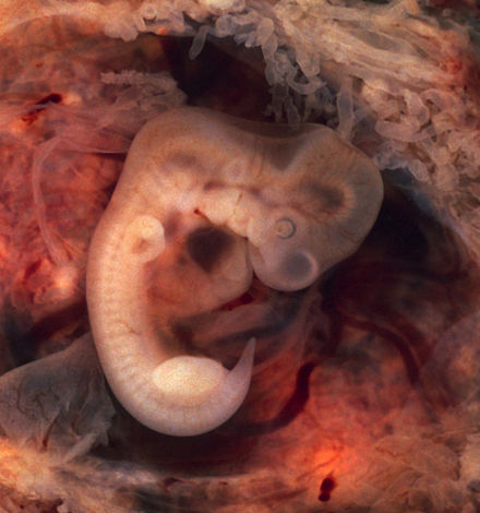Foto de embrión de siete semanas